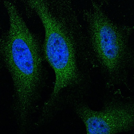 Image kindly submitted by an end-user via Funakoshi. 4% Paraformaldehyde fixed HeLa cells stained with  Rabbit Anti-Cytochrome C Polyclonal Antibody (bs-0013R) at 1:100 for 2 hours at room temperature