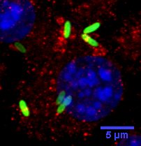 Image kindly submitted by M. G. Connor as part of the free sample program. The bacteria Zprojection image figure legend: RAW264.7 Macrophage cells infected with GFP-bacteria (MOI3), stained with ATG4B primary antibody (1:1000) and visualized with Alexa Flour 595 (red). Nucleus is stained with DAPI (blue). Coverslips mounted with Prolong Gold Antifade with DAPI. Zprojections generated using FIJI. Scale bar is 5um. Images courtesy of M. G. Connor 2014