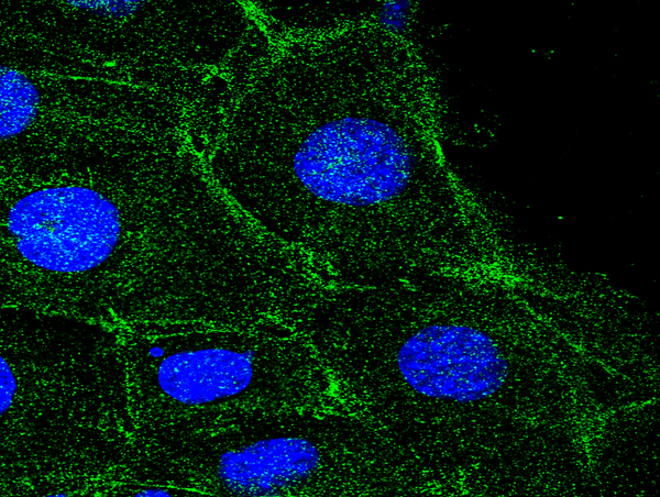 Image kindly submitted by Piotr Mamczur from Wroclaw University. Immunofluorescent localization of beta actin in mouse squamous cell cancer (KLN-205 cell line) with BS-0061R (1:50) antibody and FITC-labeled secondary antibodies (1:2000). The nuclei were stained with DAPI.