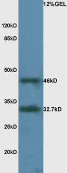 Mouse brain lysate probed with Rabbit Anti-LAMR1 Polyclonal Antibody, Unconjugated (bs-0900R) at 1:200 overnight at 4˚C. Followed by conjugation to secondary antibody (bs-0295G-HRP) at 1:3000 for 90 min at 37˚C.