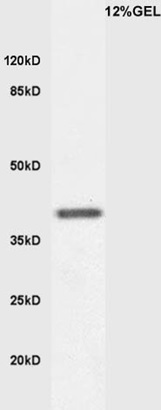 Mouse embryo lysates probed with Anti KLF2 Polyclonal Antibody, Unconjugated (bs-2772R) at 1:200 overnight at 4˚C. Followed by conjugation to secondary antibody (bs-0295G-HRP) at 1:3000 for 90 min at 37˚C.