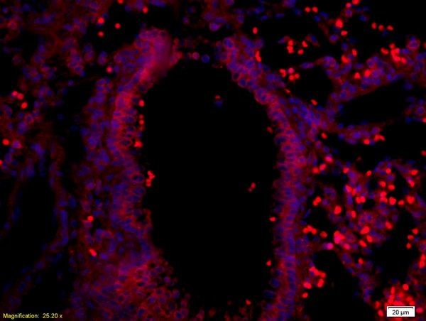 Formalin-fixed and paraffin-embedded rat lung labeled with Anti-Myelin Protein Zero Polyclonal Antibody, Unconjugated (bs-0337R)at 1:200 followed by conjugation to the secondary antibody and DAPI staining