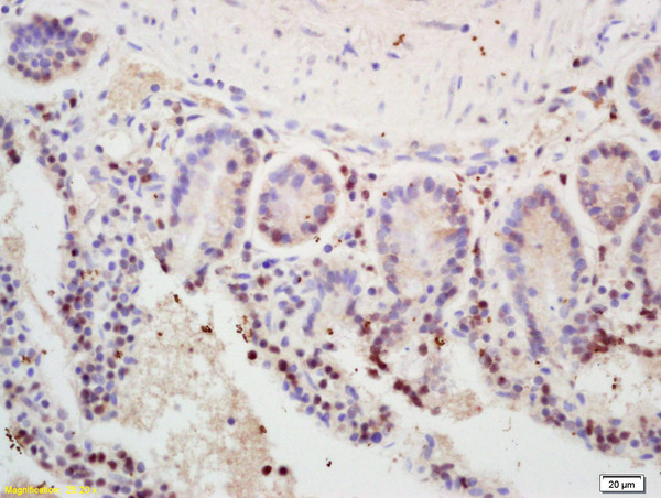 Formalin-fixed and paraffin embedded mouse intestine labeled with  Rabbit Anti MSH2 Polyclonal Antibody, Unconjugated (bs-0758R) at 1:200 followed by conjugation to the secondary antibody and DAB staining