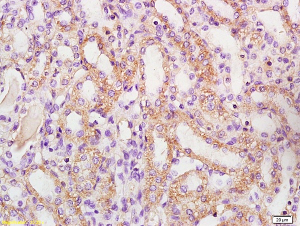 Formalin-fixed and paraffin embedded rat kidney labeled with Anti-phospho-BAD (Ser128) Polyclonal Antibody, Unconjugated (bs-0893R) at 1:200 followed by conjugation to the secondary antibody and DAB staining\n