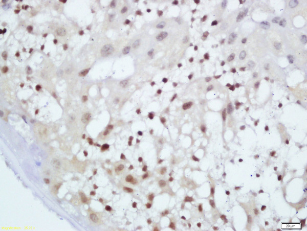 Formalin-fixed and paraffin embedded mouse placenta labeled with Anti-GnRHR Polyclonal Antibody, Unconjugated (bs-1464R) at 1:200 followed by conjugation to the secondary antibody and DAB staining