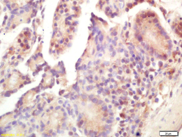 Formalin-fixed and paraffin embedded mouse intestine labeled with Rabbit Anti Smac/DIABLO Polyclonal Antibody, Unconjugated (bs-1298R) at 1:200 followed by conjugation to the secondary antibody and DAB staining