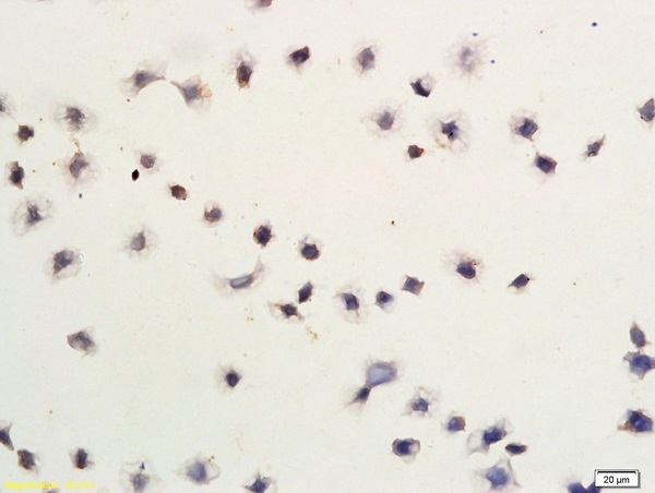 Gastric Cancer Cells labeled with Anti-Smac/DIABLO Polyclonal Antibody, Unconjugated (bs-1298R) followed by conjugation to the secondary antibody