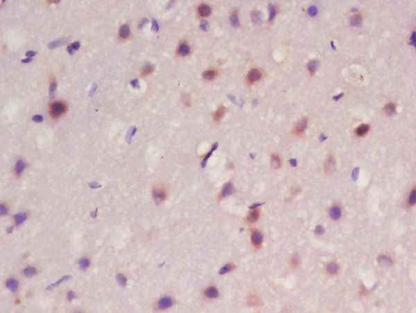 Formalin-fixed and paraffin embedded rat brain labeled with Rabbit Anti-Frizzled 10\/CD350 Polyclonal Antibody, Unconjugated (bs-13216R) at 1:200 followed by conjugation to the secondary antibody and DAB staining