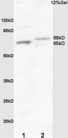 L1 mouse embryo lysate L2 human colon carcinoma lysates probed with Rabbit Anti-Frizzled 10\/CD350 Polyclonal Antibody, Unconjugated (bs-13216R) at 1:200 overnight at 4˚C. Followed by conjugation to secondary antibody (bs-0295G-HRP) at 1:3000 for 90 min at 37˚C.