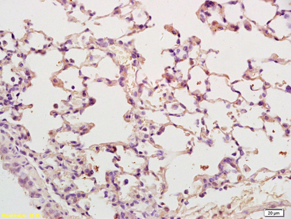 Formalin-fixed and paraffin embedded mouse lung labeled with Anti-PEN2 Polyclonal Antibody (bs-6456R) at 1:200 followed by conjugation to the secondary antibody and DAB staining.