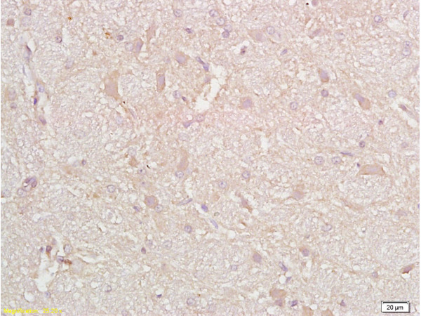 Formalin-fixed and paraffin embedded rat brain tissue with labeled Anti-CD38 Polyclonal Antibody, Unconjugated (bs-0979R) at 1:200, followed by conjugation to the secondary antibody and DAB staining