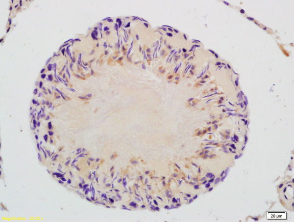 Formalin-fixed and paraffin embedded rat testis labeled with Rabbit Anti-GAPDHS/GAPDH2 Polyclonal Antibody, Unconjugated (bs-13282R) at 1:200 followed by conjugation to the secondary antibody and DAB staining