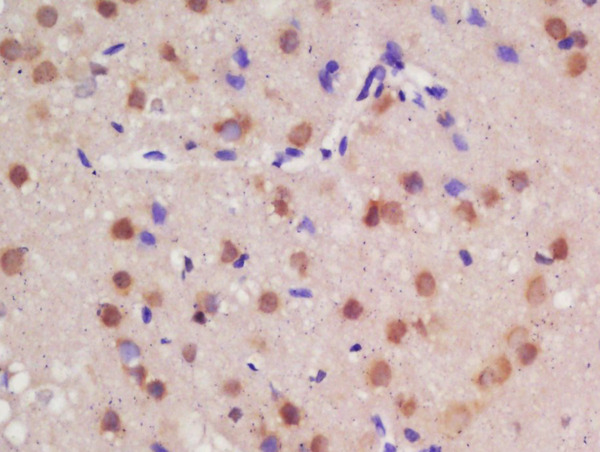 Formalin-fixed and paraffin embedded rat brain labeled with Rabbit Anti-Guanylyl Cyclase alpha 1 Polyclonal Antibody, Unconjugated (bs-13544R) at 1:200 followed by conjugation to the secondary antibody and DAB staining\n