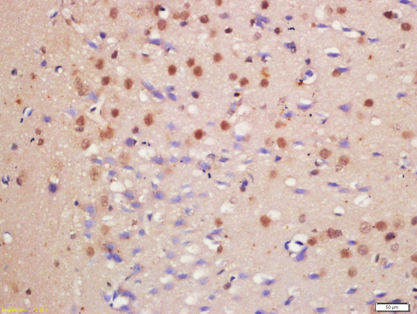 Formalin-fixed and paraffin embedded rat brain labeled with Anti-HDAC3/HD3 Polyclonal Antibody, Unconjugated (bs-10024R) at 1:200 followed by conjugation to the secondary antibody and DAB staining\n