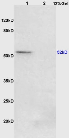 Lane 1: mouse lung lysates Lane 2: mouse stomach lysates probed with Anti Phospho-PPAR Gamma (ser273) Polyclonal Antibody, Unconjugated (bs-4888R) at 1:200 in 4˚C. Followed by conjugation to secondary antibody (bs-0295G-HRP) at 1:3000 90min in 37˚C. Predicted band 52kD. Observed band size: 52kD.\\n