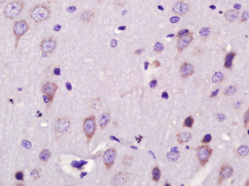 Paraformaldehyde-fixed, paraffin embedded Rat brain; Antigen retrieval by boiling in sodium citrate buffer (pH6.0) for 15min; Block endogenous peroxidase by 3% hydrogen peroxide for 20 minutes; Blocking buffer (normal goat serum) at 37°C for 30min; Antibody incubation with NRG3 Polyclonal Antibody, Unconjugated (bs-6235R) at 1:400 overnight at 4°C, DAB staining.