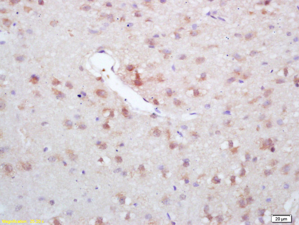 Formalin-fixed and paraffin embedded rat brain labeled with Rabbit Anti GAD67/GAD1 Polyclonal Antibody, Unconjugated (bs-1302R) at 1:200 followed by conjugation to the secondary antibody and DAB staining
