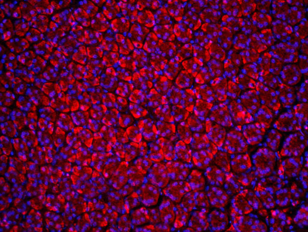 Formalin-fixed and paraffin-embedded rat stomach labeled with Anti-Beclin 1\/ATG6 Polyclonal Antibody, Unconjugated(bs-1353R) 1:200, overnight at 4\u00b0C, The secondary antibody was Goat Anti-Rabbit IgG, Cy3 conjugated(bs-0295G-Cy3)used at 1:200 dilution for 40 minutes at 37\u00b0C.
