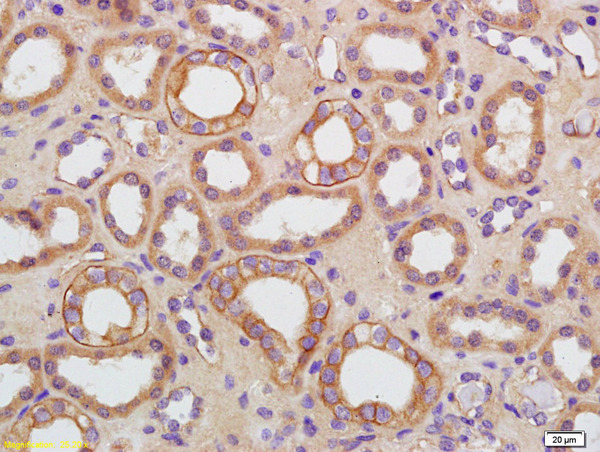 Formalin-fixed and paraffin embedded human kidney labeled with Rabbit Anti-AQP9 Polyclonal Antibody, Unconjugated (bs-2060R) at 1:200 followed by conjugation to the secondary antibody and DAB staining\n