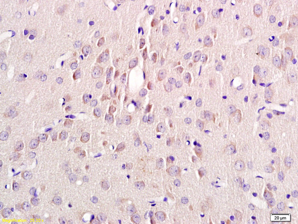 Formalin-fixed and paraffin embedded rat brain labeled with Rabbit Anti Annexin A13 Polyclonal Antibody, Unconjugated (bs-12478R) at 1:200 followed by conjugation to the secondary antibody and DAB staining