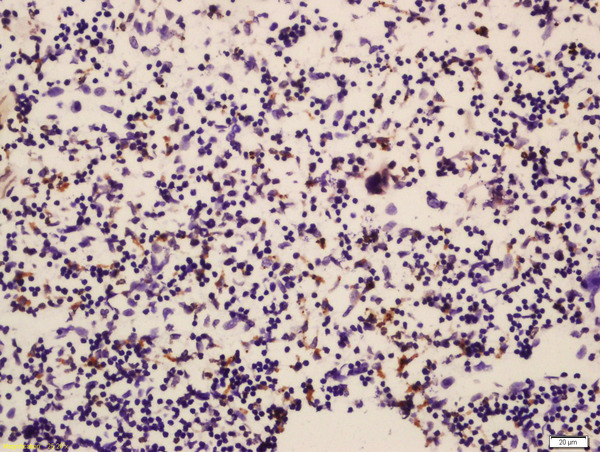 Formalin-fixed and paraffin embedded mouse spleen labeled with Rabbit Anti-RUNX1 Polyclonal Antibody, Unconjugated (bs-2744R) at 1:200 followed by conjugation to the secondary antibody and DAB staining\n