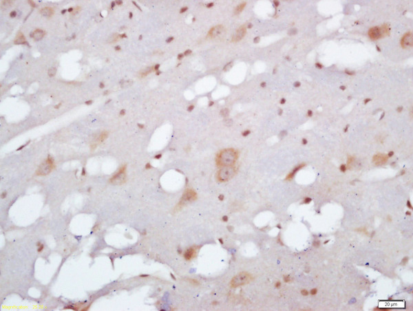 Formalin-fixed and paraffin embedded rat brain labeled with Anti-EXOC2/SEC5 Polyclonal Antibody, Unconjugated (bs-13118R) at 1:200 followed by conjugation to the secondary antibody and DAB staining