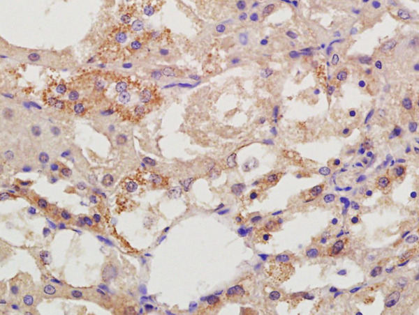 Formalin-fixed and paraffin embedded rat kidney labeled with Rabbit Anti-DIAPH2/Dia2 Polyclonal Antibody, Unconjugated (bs-13002R) at 1:200 followed by conjugation to the secondary antibody and DAB staining