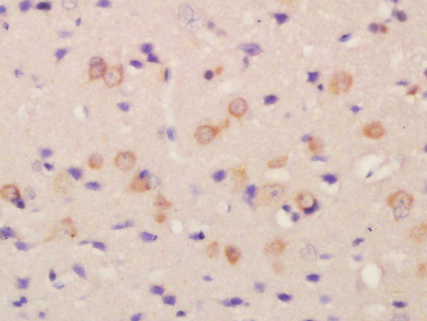 Formalin-fixed and paraffin embedded rat brain labeled with Rabbit Anti-FLRT2 Polyclonal Antibody, Unconjugated (bs-12561R) at 1:200 followed by conjugation to the secondary antibody and DAB staining