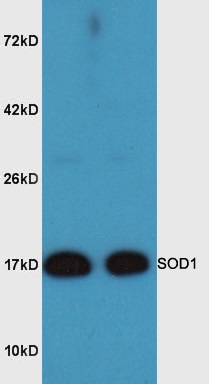 Mouse brain lysates probed with Rabbit Anti-SOD1 Polyclonal Antibody, Unconjugated (bs-10216R) at 1:300 overnight at 4˚C. Followed by conjugation to secondary antibody (bs-0295G-HRP) at 1:3000 for 90 min at 37˚C.