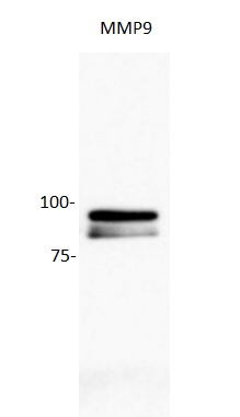 Image kindly submitted by Hailing Yang. Human glioblastoma cell line (U87) probed with Rabbit Anti-MMP9 Polyclonal Antibody (bs-0397R).