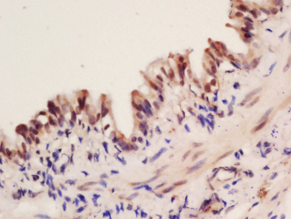 Formalin-fixed and paraffin embedded mouse lung labeled with Rabbit Anti-Fox2/RBM9 Polyclonal Antibody, Unconjugated (bs-12299R) at 1:200 followed by conjugation to the secondary antibody and DAB staining