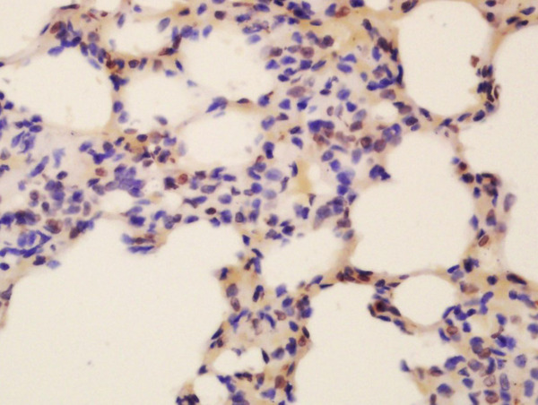 Formalin-fixed and paraffin embedded mouse lung labeled with Rabbit Anti-Fox2/RBM9 Polyclonal Antibody, Unconjugated (bs-12299R) at 1:200 followed by conjugation to the secondary antibody and DAB staining