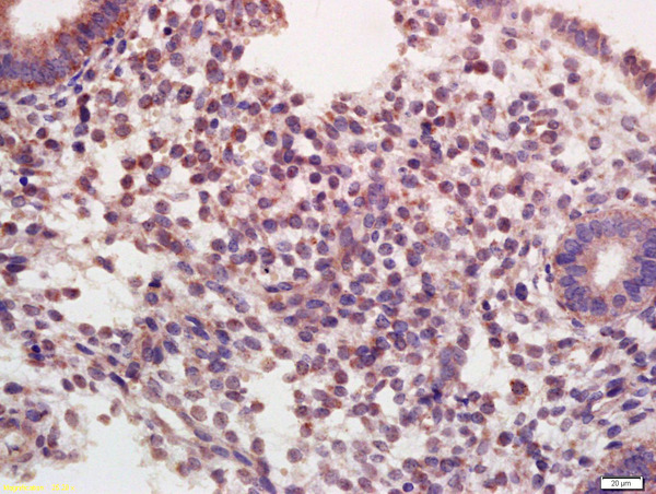 Formalin-fixed and paraffin embedded human endometrium  labeled with Rabbit Anti-Oxytocin R Polyclonal Antibody, Unconjugated (bs-1314R) at 1:200 followed by conjugation to the secondary antibody and DAB staining