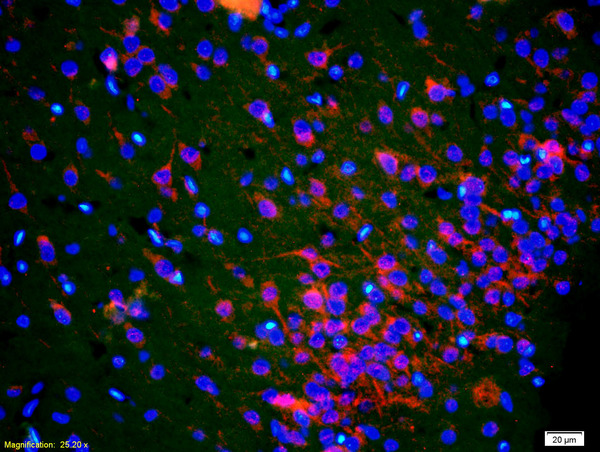 Formalin-fixed and paraffin-embedded rat brain labeled with Anti-PEN2 Polyclonal Antibody, Unconjugated(bs-6456R) 1:200, overnight at 4\u00b0C, The secondary antibody was Goat Anti-Rabbit IgG, Cy3conjugated(bs-0295G-Cy3)used at 1:200 dilution for 40 minutes at 37\u00b0C.