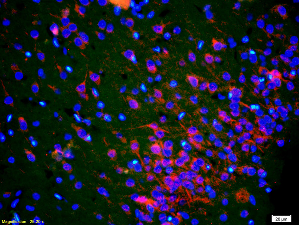 Formalin-fixed and paraffin-embedded rat brain labeled with Anti-PEN2 Polyclonal Antibody, Unconjugated(bs-6456R) 1:200, overnight at 4°C, The secondary antibody was Goat Anti-Rabbit IgG, Cy3conjugated(bs-0295G-Cy3)used at 1:200 dilution for 40 minutes at 37°C.