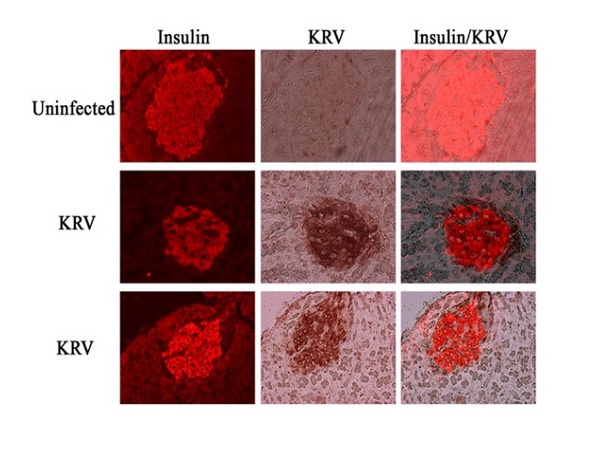 Kilham Rat Virus/KRV-VP1/KRV-VP2 Antibody – Bioss