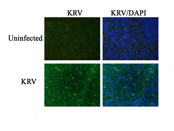 Image kindly submitted by Dr. Zipris from the University of Colorado Denver.\\n\\nRat spleen probed with Rabbit Anti-Kilham Rat Virus\/KRV-VP1\/KRV-VP2 Polyclonal Antibody.
