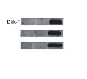 Image kindly provided by Dr. Magdalena Krol. Control tumor cells, tumor cells grown in macrophage-conditioned medium, tumor cells sorted from co-culture with macrophages, and macrophages from monocultures and sorted from co-culture with tumor cells were analyzed. Total protein concentrations in lysates were determined using a Bio-Rad protein assay. Proteins (50 mg) were resolved using SDS-PAGE and transferred onto PVDF membranes. The membranes were then blocked with 5% non-fat dry milk in TBS buffer containing 0.5% Tween 20. The membranes were then incubated overnight with the primary Rabbit Anti-DKK1 Polyclonal Antibody at 1:100 dilution. Subsequently, the membranes were washed three times in TBS containing 0.5% Tween 20 and incubated for 1 h at room temperature with secondary antibodies conjugated with the appropriate infrared (IR) fluorophore IRDyeH 800 CW or IRDyeH 680 RD at a dilution of 1:5000.