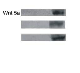 Image kindly provided by Dr. Magdalena Krol. Control tumor cells, tumor cells grown in macrophage-conditioned medium, tumor cells sorted from co-culture with macrophages, and macrophages from monocultures and sorted from co-culture with tumor cells were analyzed. Total protein concentrations in lysates were determined using a Bio-Rad protein assay. Proteins (50 mg) were resolved using SDS-PAGE and transferred onto PVDF membranes. The membranes were then blocked with 5% non-fat dry milk in TBS buffer containing 0.5% Tween 20. The membranes were then incubated overnight with the primary Rabbit Anti-WNT5A Polyclonal Antibody at 1:100 dilution. Subsequently, the membranes were washed three times in TBS containing 0.5% Tween 20 and incubated for 1 h at room temperature with secondary antibodies conjugated with the appropriate infrared (IR) fluorophore IRDyeH 800 CW or IRDyeH 680 RD at a dilution of 1:5000.