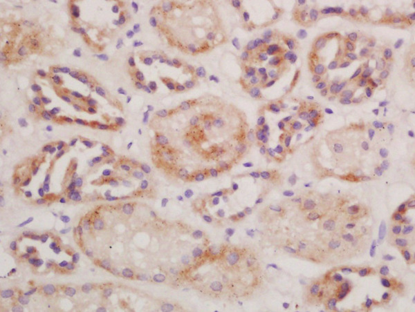 Formalin-fixed and paraffin embedded mouse kidney labeled with Rabbit Anti-CD13/APN/ANPEN Polyclonal Antibody, Unconjugated (bs-1383R) at 1:200 followed by conjugation to the secondary antibody and DAB staining