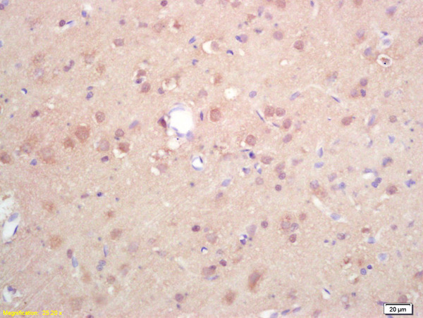 Formalin-fixed and paraffin embedded rat brain labeled with Rabbit Anti DGAT1/Diglyceride acyltransferase Polyclonal Antibody, Unconjugated (bs-2332R) at 1:200 followed by conjugation to the secondary antibody and DAB staining
