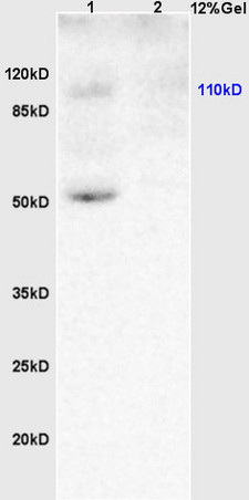 L1 rat brain lysates L2 human colon carcinoma lysates probed with Anti KLF5\/UKHC Polyclonal Antibody, Unconjugated (bs-2385R) at 1:200 overnight at 4˚C. Followed by conjugation to secondary antibody (bs-0295G-HRP) at 1:3000 for 90 min at 37˚C. Predicted band 50kD. Observed band size:50kD.\\n