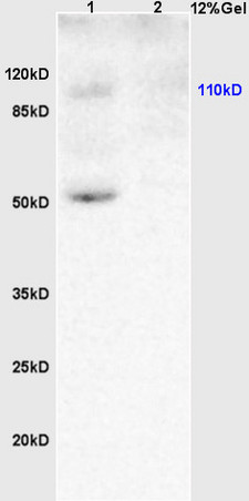 L1 rat brain lysates L2 human colon carcinoma lysates probed with Anti KLF5/UKHC Polyclonal Antibody, Unconjugated (bs-2385R) at 1:200 overnight at 4˚C. Followed by conjugation to secondary antibody (bs-0295G-HRP) at 1:3000 for 90 min at 37˚C. Predicted band 50kD. Observed band size:50kD.\n