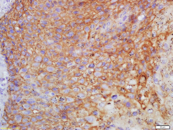 Formalin-fixed and paraffin embedded human endometrium labeled with Anti-FSH/FSHB Polyclonal Antibody, Unconjugated (bs-1536R) at 1:200 followed by conjugation to the secondary antibody and DAB staining\n