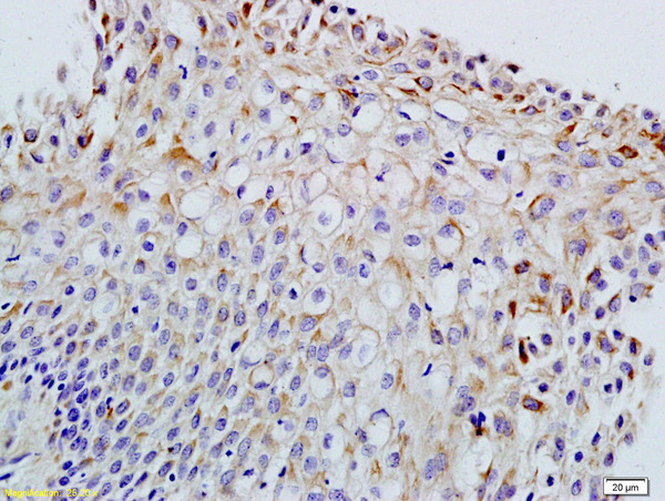 Formalin-fixed and paraffin embedded rat ovary labeled with Anti-FSH/FSHB Polyclonal Antibody, Unconjugated (bs-1536R) at 1:200 followed by conjugation to the secondary antibody and DAB staining\n