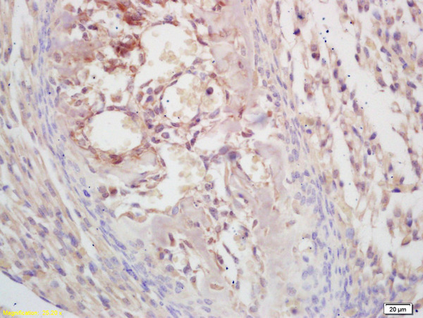 Formalin-fixed and paraffin embedded mouse embryo labeled with  Rabbit Anti KLF5\/UKHC Polyclonal Antibody, Unconjugated (bs-2385R) at 1:200 followed by conjugation to the secondary antibody and DAB staining