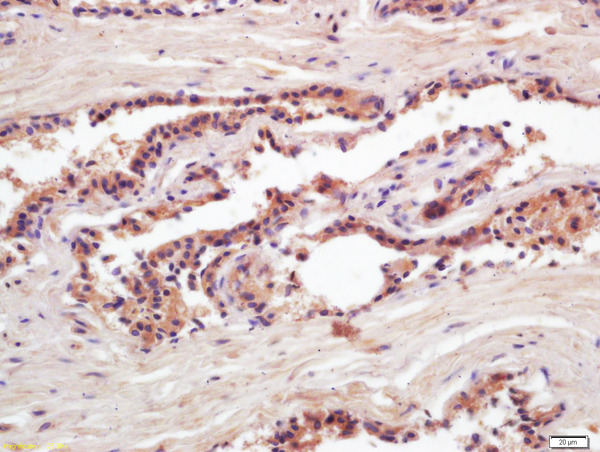 Formalin-fixed and paraffin embedded rat submandibular gland labeled with Mouse Anti-PSA(Pa3) Monoclonal Antibody (bsm-1625M) at 1:200 followed by conjugation to the secondary antibody and DAB staining\n