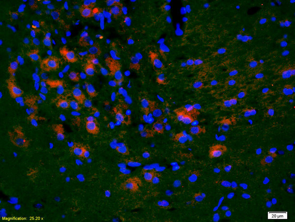 Formalin-fixed and paraffin-embedded rat brain labeled with Anti-KLF5\/UKHC Polyclonal Antibody, Unconjugated(bs-2385R) 1:200, overnight at 4\u00b0C, The secondary antibody was Goat Anti-Rabbit IgG, Cy3 conjugated(bs-0295G-Cy3)used at 1:200 dilution for 40 minutes at 37\u00b0C.