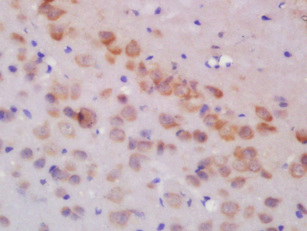 Formalin-fixed and paraffin embedded rat brain labeled with Rabbit Anti-GLUR3 Polyclonal Antibody, Unconjugated (bs-1799R) at 1:200 followed by conjugation to the secondary antibody and DAB staining\n Formalin-fixed and paraffin embedded rat brain labeled with Rabbit Anti-GLUR3 Polyclonal Antibody, Unconjugated (bs-1799R) at 1:200 followed by conjugation to the secondary antibody and DAB staining\n