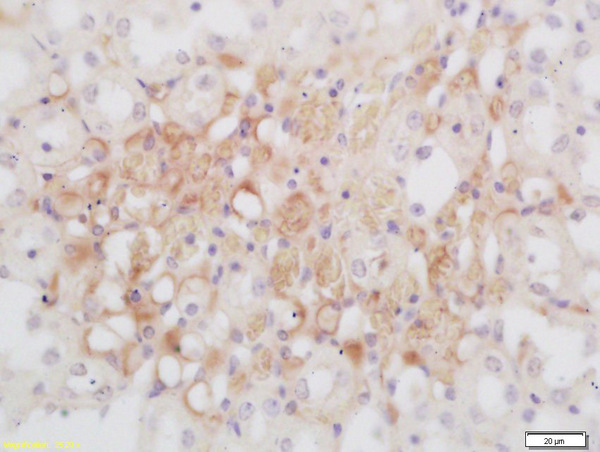Formalin-fixed and paraffin embedded rat kidney labeled with Rabbit Anti GNMT Polyclonal Antibody, Unconjugated (bs-2396R) at 1:200 followed by conjugation to the secondary antibody and DAB staining